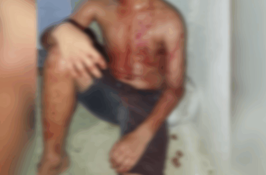  Menino de 10 Anos é Brutalmente Esfaqueado por Adolescente em Ji-Paraná