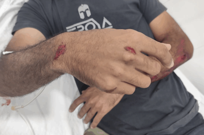  Briga Entre Ex-Casal Termina em Perseguição, Acidente e Ameaças com Faca em Ji-Paraná