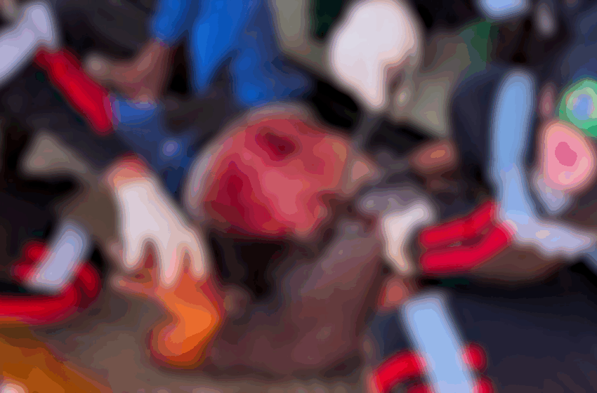  Homem Esfaqueado na Av. Brasil Luta pela Vida em Ji-Paraná