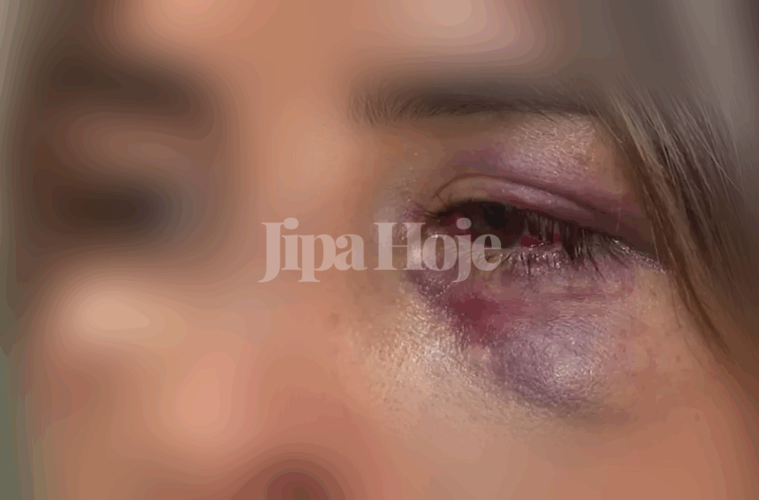  Filho ‘Noiado’ Espanca a Própria Mãe e Foge em Ji-Paraná